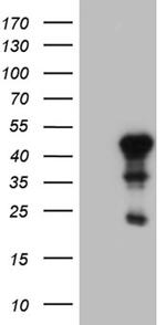 ELF3 Antibody in Western Blot (WB)
