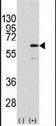 ELK1 Antibody in Western Blot (WB)