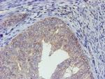 ELK3 Antibody in Immunohistochemistry (Paraffin) (IHC (P))