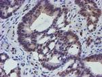 ELK3 Antibody in Immunohistochemistry (Paraffin) (IHC (P))
