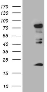 ELL Antibody in Western Blot (WB)