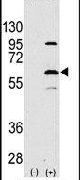 ELP3 Antibody in Western Blot (WB)
