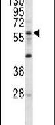 ELP3 Antibody in Western Blot (WB)