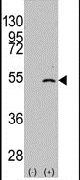 ELP3 Antibody in Western Blot (WB)