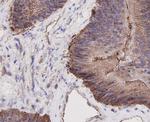 Beta-Catenin Antibody in Immunohistochemistry (Paraffin) (IHC (P))