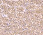 Beta-Catenin Antibody in Immunohistochemistry (Paraffin) (IHC (P))