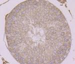 Beta-Catenin Antibody in Immunohistochemistry (Paraffin) (IHC (P))