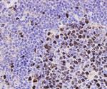 PCNA Antibody in Immunohistochemistry (Paraffin) (IHC (P))