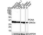 PCNA Antibody in Immunohistochemistry (Paraffin) (IHC (P))