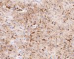 GFAP Antibody in Immunohistochemistry (Paraffin) (IHC (P))