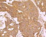 EGFR Antibody in Immunohistochemistry (Paraffin) (IHC (P))