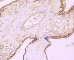 EGFR Antibody in Immunohistochemistry (Paraffin) (IHC (P))