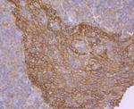 EGFR Antibody in Immunohistochemistry (Paraffin) (IHC (P))