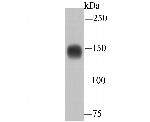 EGFR Antibody in Western Blot (WB)