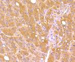 AFP Antibody in Immunohistochemistry (Paraffin) (IHC (P))