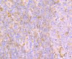 AFP Antibody in Immunohistochemistry (Paraffin) (IHC (P))