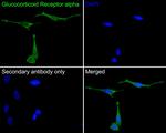 Glucocorticoid Receptor alpha Antibody in Immunocytochemistry (ICC/IF)