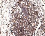 Glucocorticoid Receptor alpha Antibody in Immunohistochemistry (Paraffin) (IHC (P))
