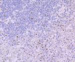 Glucocorticoid Receptor alpha Antibody in Immunohistochemistry (Paraffin) (IHC (P))