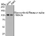 Glucocorticoid Receptor alpha Antibody in Western Blot (WB)