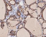 Bcl-2 Antibody in Immunohistochemistry (Paraffin) (IHC (P))