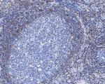 Bcl-2 Antibody in Immunohistochemistry (Paraffin) (IHC (P))