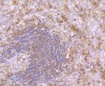 Calpain 1 Antibody in Immunohistochemistry (Paraffin) (IHC (P))