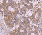 Calpain 1 Antibody in Immunohistochemistry (Paraffin) (IHC (P))