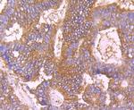 Calpain 1 Antibody in Immunohistochemistry (Paraffin) (IHC (P))