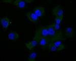 MMP9 Antibody in Immunocytochemistry (ICC/IF)