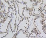 MMP9 Antibody in Immunohistochemistry (Paraffin) (IHC (P))
