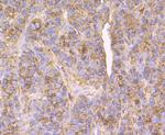 Cathepsin D Antibody in Immunohistochemistry (Paraffin) (IHC (P))