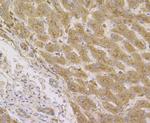 Cathepsin D Antibody in Immunohistochemistry (Paraffin) (IHC (P))