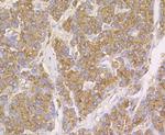 Cathepsin D Antibody in Immunohistochemistry (Paraffin) (IHC (P))