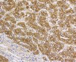 Cathepsin D Antibody in Immunohistochemistry (Paraffin) (IHC (P))