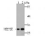 Cathepsin D Antibody in Western Blot (WB)
