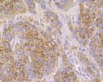Cathepsin D Antibody in Immunohistochemistry (Paraffin) (IHC (P))
