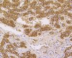 Cathepsin D Antibody in Immunohistochemistry (Paraffin) (IHC (P))