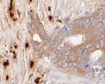 Myeloperoxidase Antibody in Immunohistochemistry (Paraffin) (IHC (P))