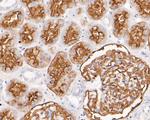 CD10 Antibody in Immunohistochemistry (Paraffin) (IHC (P))