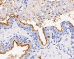 CD10 Antibody in Immunohistochemistry (Paraffin) (IHC (P))