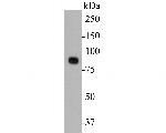 CD10 Antibody in Western Blot (WB)