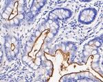 CD10 Antibody in Immunohistochemistry (Paraffin) (IHC (P))