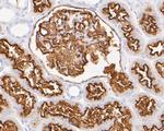 CD10 Antibody in Immunohistochemistry (Paraffin) (IHC (P))