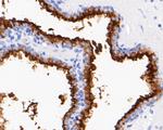 CD10 Antibody in Immunohistochemistry (Paraffin) (IHC (P))