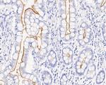 CD10 Antibody in Immunohistochemistry (Paraffin) (IHC (P))