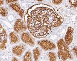 CD10 Antibody in Immunohistochemistry (Paraffin) (IHC (P))