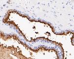 CD10 Antibody in Immunohistochemistry (Paraffin) (IHC (P))