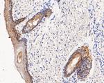 Cytokeratin 14 Antibody in Immunohistochemistry (Paraffin) (IHC (P))