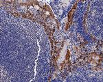 Cytokeratin 14 Antibody in Immunohistochemistry (Paraffin) (IHC (P))